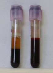 Blood samples