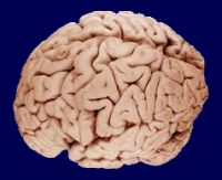 Alterations in this immensely complicated structure lead to the related symptoms of HD